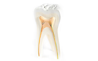 cambridge-painless_rootcanal